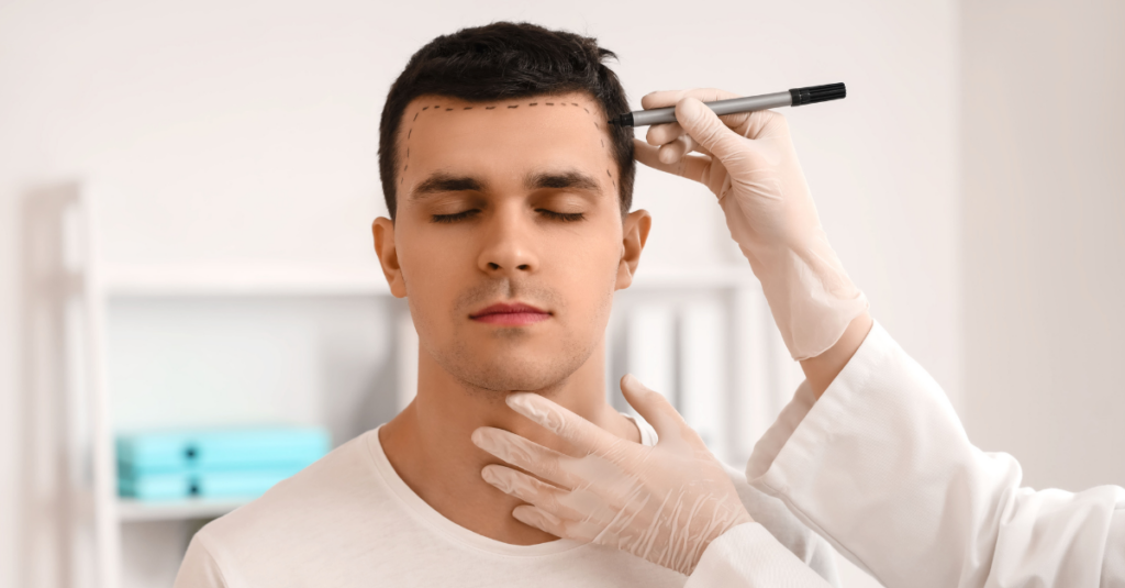 Medical Tourism for Hair Treatments and Transplants