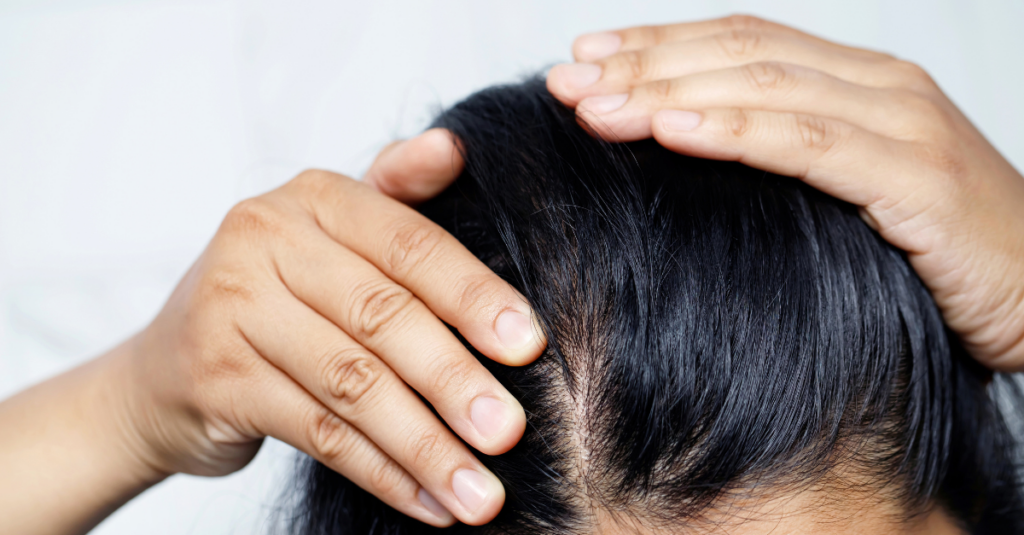 hair transplants turkey bangkok risks