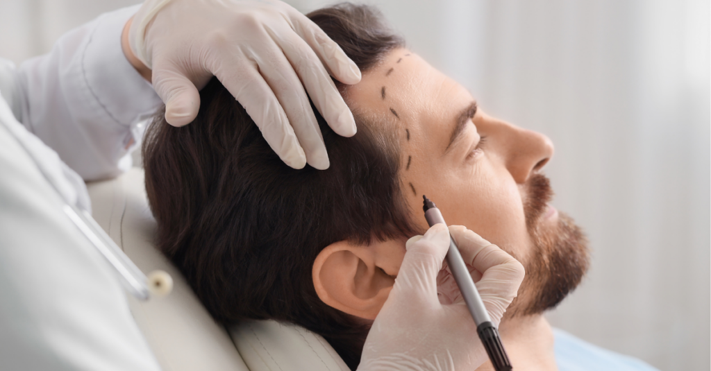 risks and realities of medical tourism for hair transplants
