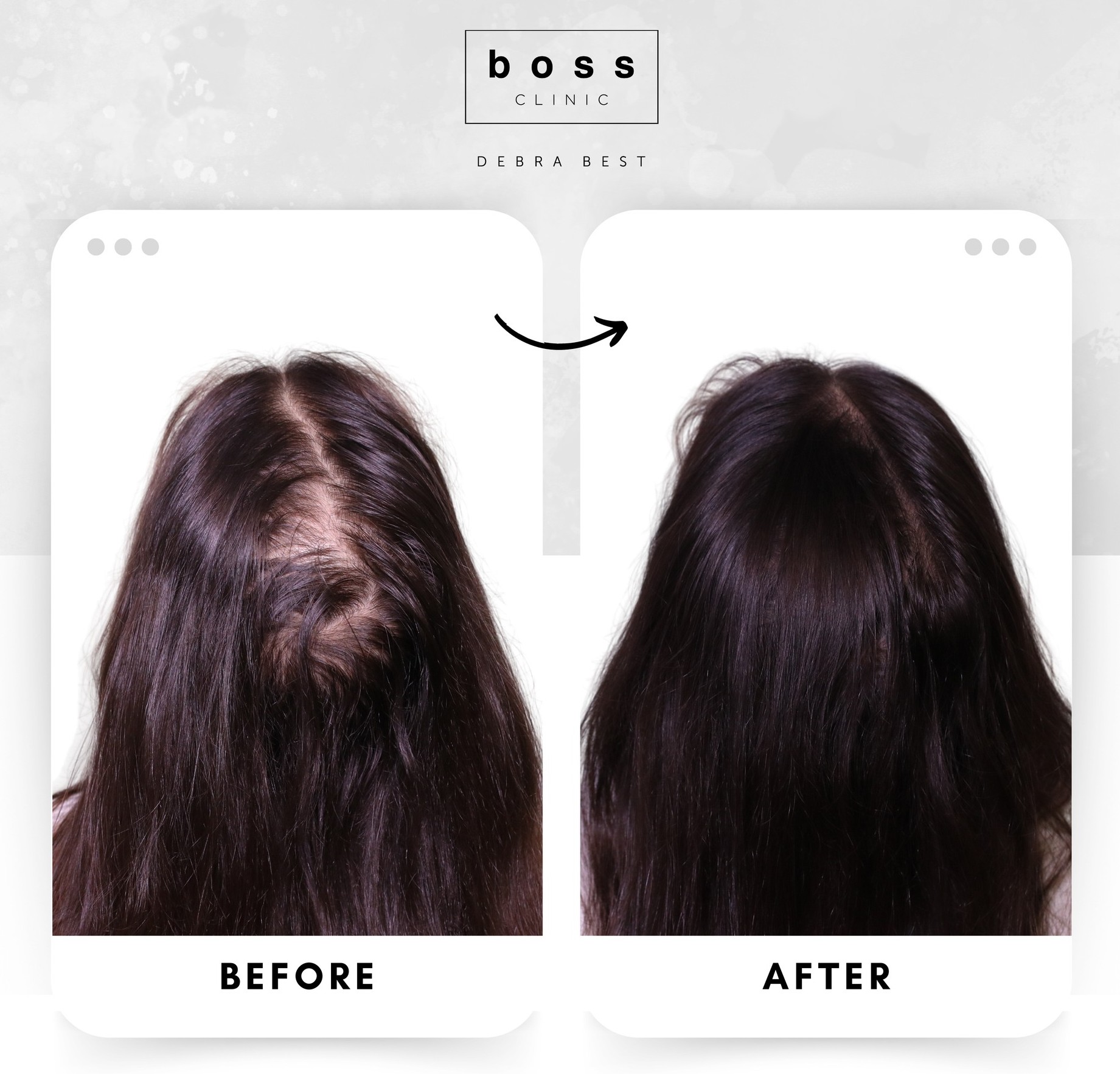 Boss-Clinic-Femal-Transformation